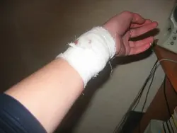 Photo of cut hands in the bathroom